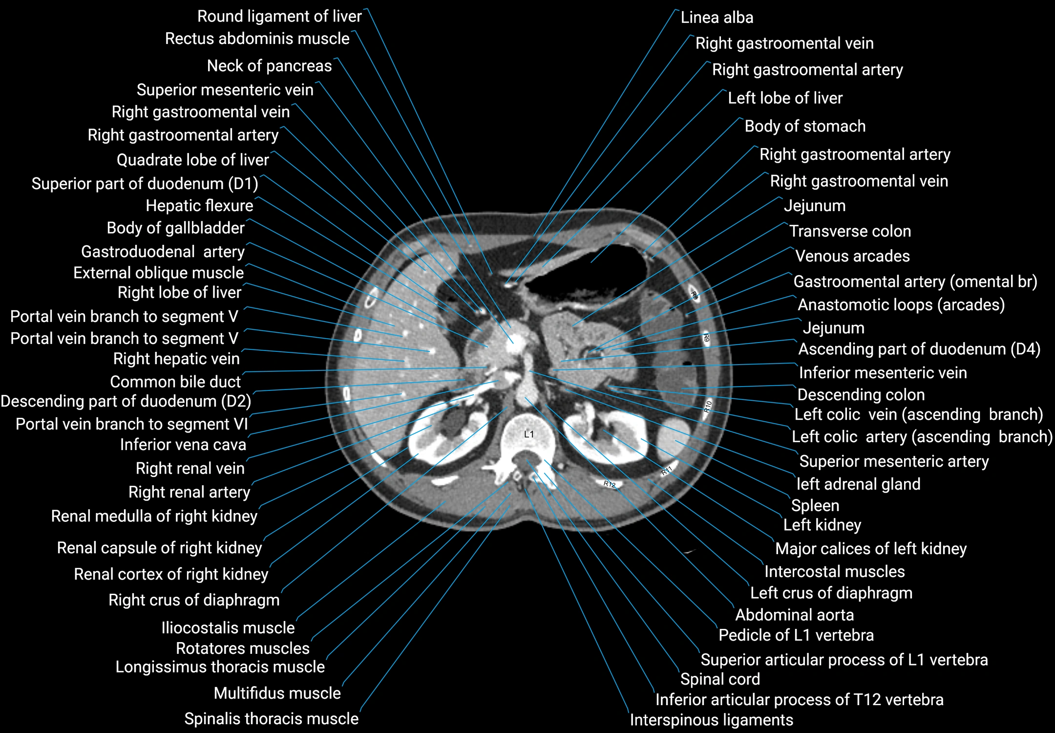 CT male pelvis axial cross sectional anatomy labelled radiology image -00054.webp